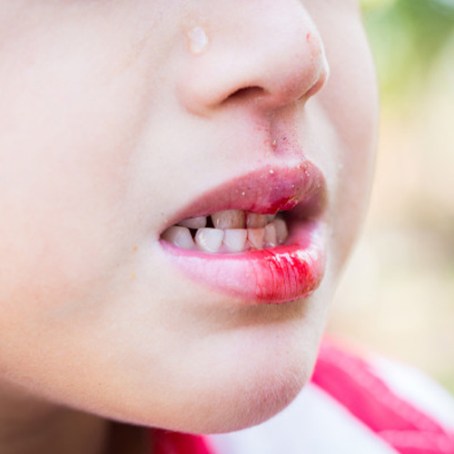 Gainesville Dental Arts Dental Emergency