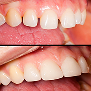 Gainesville Dental Arts Gainesville Haymarket Dental Care VA Restorative Services