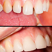 Gainesville Dental Arts Gainesville Haymarket Dental VA Restorative Related Services