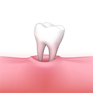 Gainesville Dental Arts Gainesville Haymarket Tooth Extraction