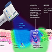 Gainesville Dental Arts Gainesville Haymarket Velscope Oral Cancer Screening