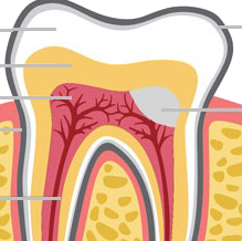 Gainesville Dental Arts Pulpotomy Related Services 
