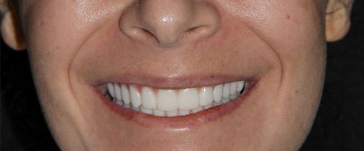 Gainesville Dental Arts Gainesville Haymarket Cosmetic Implant Dentistry Smiling