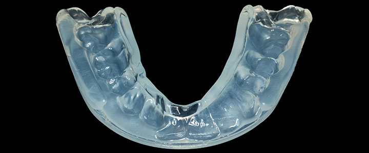 Gainesville-Dental-Arts-Gainesville Haymarket Dental Sports Guard 