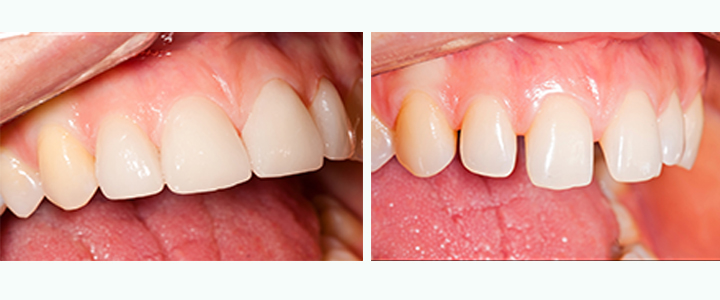 Gainesville Dental Arts Gainesville Haymarket Cosmetic Restorative Dentistry