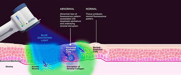 Gainesville Dental-Arts Gainesville Haymarket Velscope Oral Health Screening